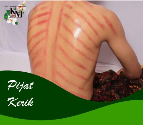 pijat kerokan terbaik ,termurah, berkualitas dan mempunyai garansi uang kembali hanya ada di pijat keluarga melati.